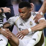 Розтин не перешкода: Мбаппе очікують у матчі Ліги чемпіонів